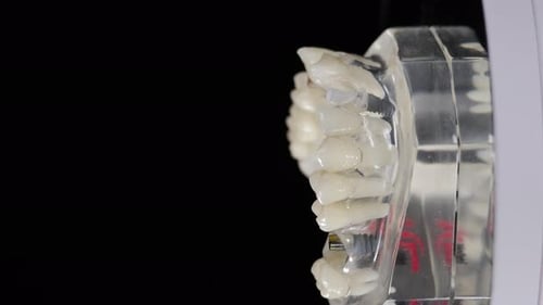 Dental Implant Jaw Model Rotating Close Up