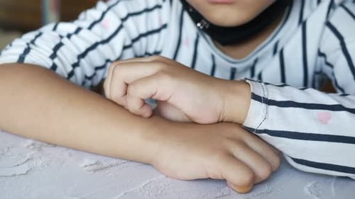 Child Scratches Itchy Arm Due to Skin Irritation