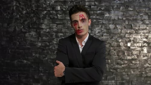 Man with Wounds and Bruises Posing