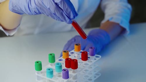 Doctor Holding Blood Sample for Testing – Close Up