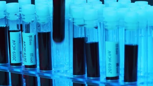 Laboratory Tubes with Blood and Virus Closeup of Scientific Lab in Hospital Epidemic Disease