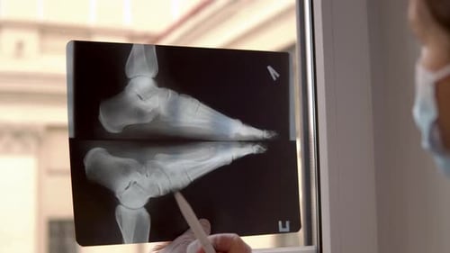 Arzt untersucht Röntgenfilm von gebrochenem Fuß