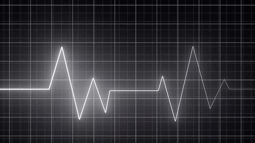 Heartbeat