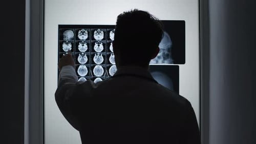 A radiologist examining patient X-rays on a lightbox