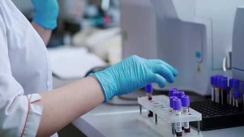 Scientists in the laboratory take biomaterial from a flask, close-up