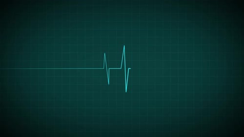 Animated Medical Heartbeat Monitor ECG Wave on Digital Grid