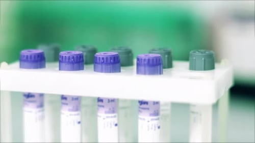 Medical Vials Placed in Rack in Laboratory