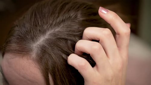 Close Up Woman Hair Split Ends Frizz Thinning or Dandruff Problems Dryness Hair Loss or Oily Scalp