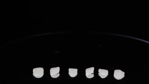 Dental Veneers and Teeth Model Close Up