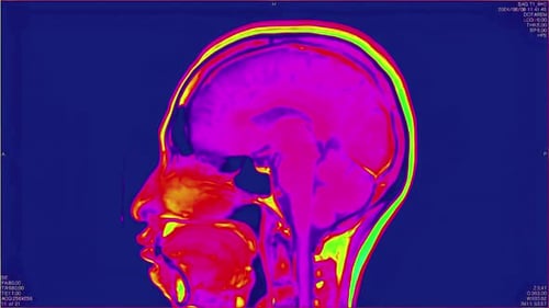 Animated MRI Scan of Human Head in Futuristic Style