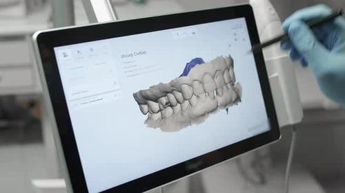 A Professional Dentist Man Looks at a 3d Model of Teeth on a Computer Monitor