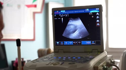 Ultrasound scanner showing a baby backbone on the screen. Close up