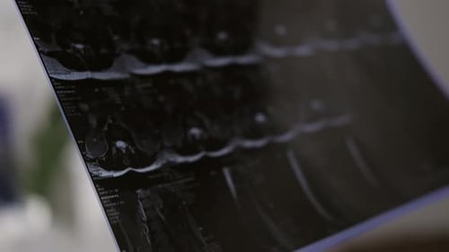 Close Up View of Hands Holding X-Ray