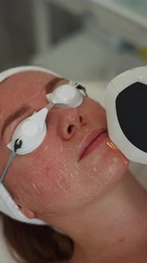 Adult Woman Receiving Skin Treatment at Medical Facility