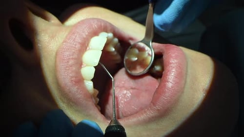 Dental Care Extreme Close Up Macro Video Dentist Treat Patient Teeth Orthodontist Works with