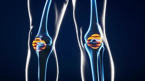 3D Medical Animation of Human Knee Joints Glowing X-ray