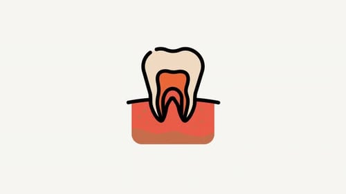 Root Canal