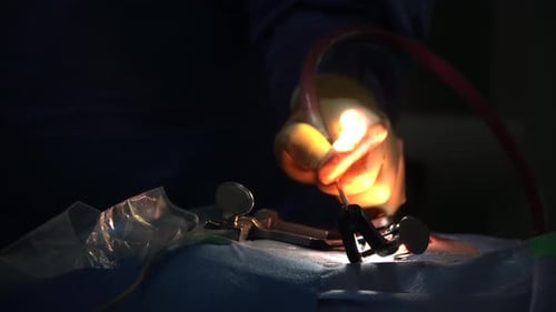 Surgeon Performing Operation Under Bright Spotlight