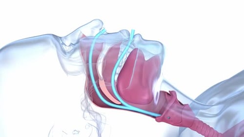 Human Head 3D Medical Animation: Airway Obstruction Simulation