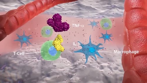 Immune Cell Interactions and Pannus Formation in Tissue