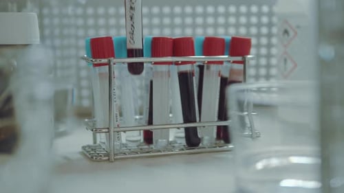 Blood Samples Being Tested in a Lab