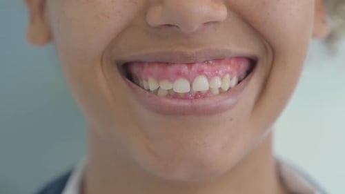 Close Up of Smiling Lips of Young African Woman