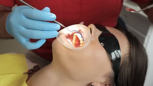 A Closeup of a Dentist Using Medical Equipment Works with a Patient in the Dental Office