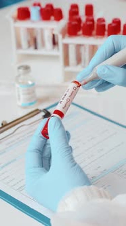 Marking COVID-19 Test Results in a Lab