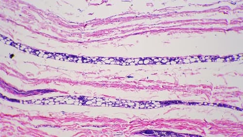 Microscopic 100x View of Human Skin with Shown Sweat Glands Against Bright Field