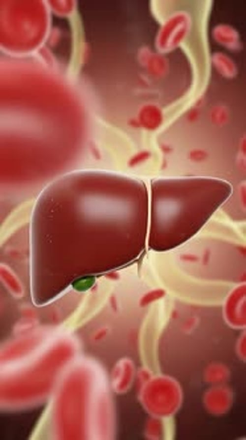 Fatty Liver Disease - Hepatic Steatosis Ultra Detailed 3D Medical Animation | Manestream Den