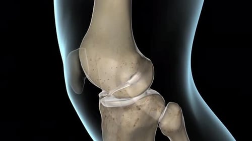 Human Knee Joint Animation Showing Ligament Tear