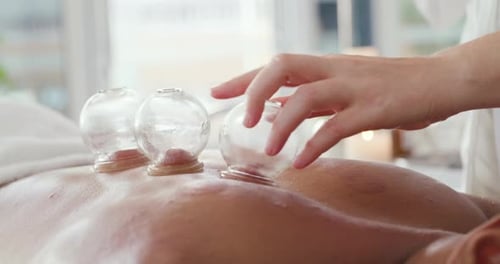 Cupping Therapy on Person's Back Close Up