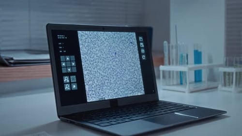 Laptop Displays Scientific Cell Image in Laboratory