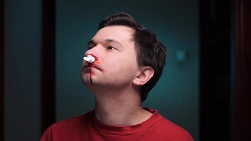 Man Suffering From Nosebleed Holding Tissue Against Nostril