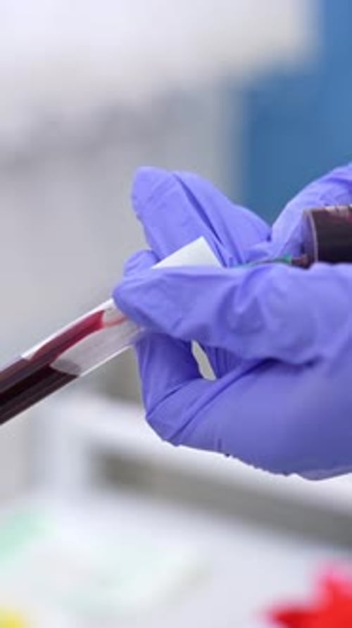 Blood Sample in Medical Laboratory with Syringe