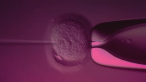 IVF in vitro fertilization through a microscope. Intracytoplasmic sperm injection