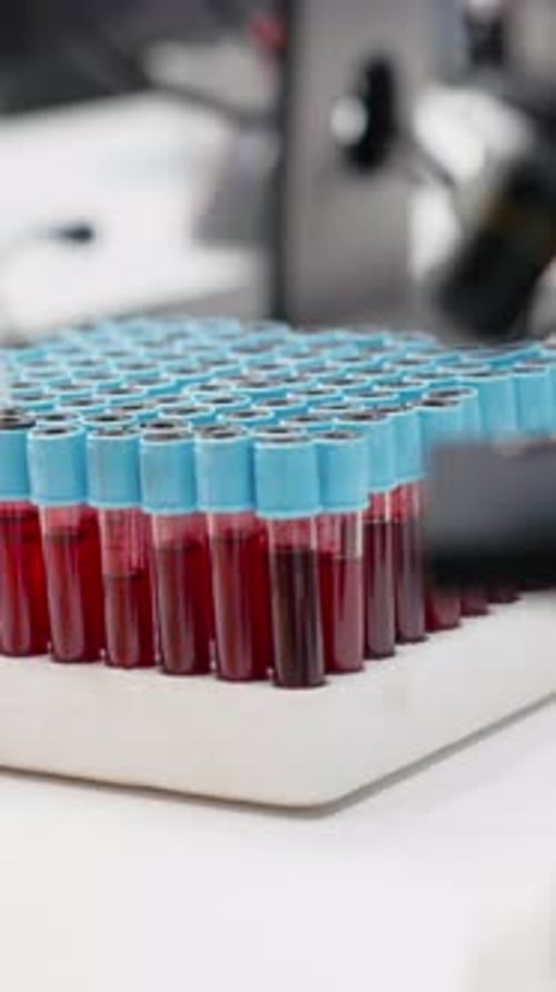 Blood Samples in Vials for Medical Testing
