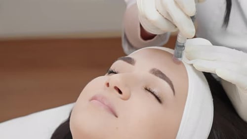 A Woman Receiving a Facial Microneedling Treatment at a Beauty Clinic Ensuring Professional Skincare