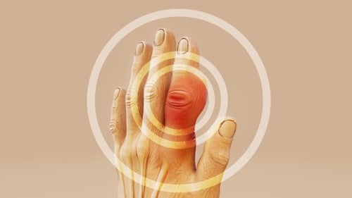 Animated Hand Showing Joint Pain and Inflammation