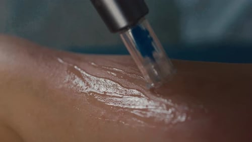 Close Up of Arm Receiving Electronic Treatment