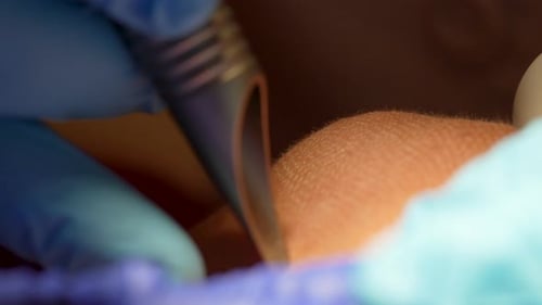 Surgical Procedure on Skin, Close-up View