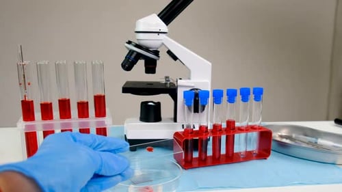Blood Sample Preparation for Microscope Analysis in Lab