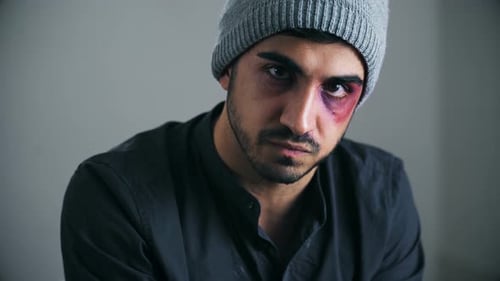 Verwundeter und geschlagener junger Mann schaut in die Kamera