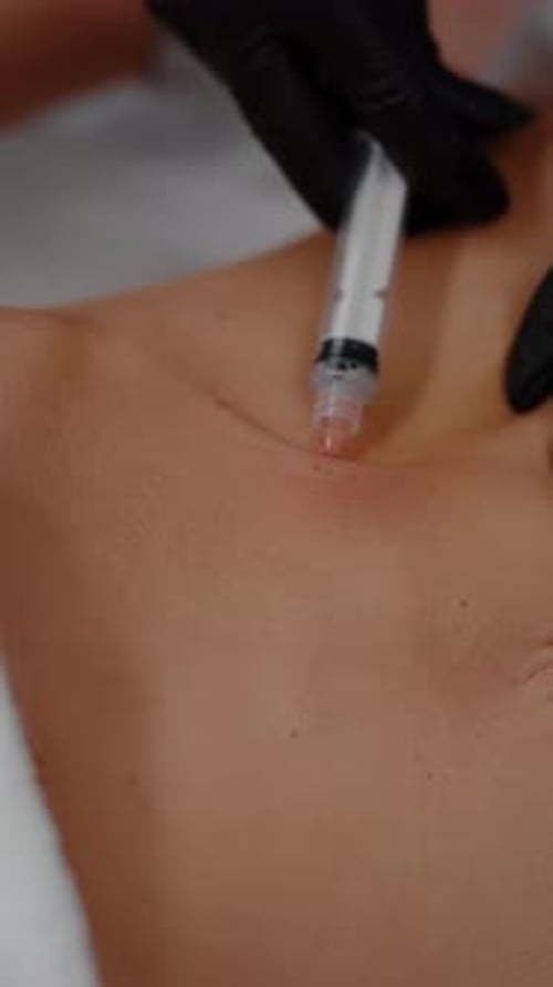 Cosmetic Injection Procedure On Patient Skin