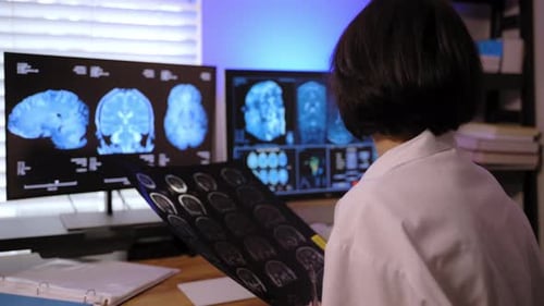 A Doctor is Analyzing MRI Scan to Diagnose Brain Conditions Medical Hospital Footage