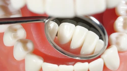 Patient at a Dentist Appointment in a Dental Clinic. View to Inside the Dental Jaw. Tooth Model