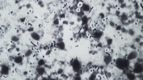 Bakterien und Mikroben unter dem Mikroskop, Pilze oder Schimmelpilze werden im wissenschaftlichen Labor untersucht