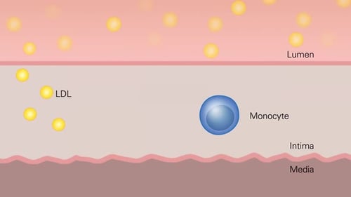 Animated Monocyte to Macrophage Transformation and Lp-PLA2 Release