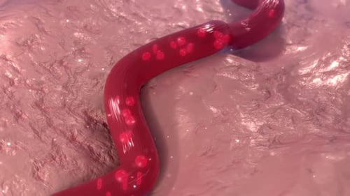 Closeup View Of Varicose Vein Formation