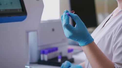 Medical Worker Analyzes Blood Sample in Lab